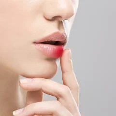AJ VÁS ČASTO POTRÁPI OPAKUJÚCI SA HERPES ČI PÁSOVÝ OPAR? AJ VÁS ČASTO POTRÁPI OPAKUJÚCI SA HERPES ČI PÁSOVÝ OPAR?